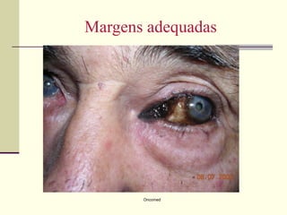 Margens adequadas




       Oncomed
 