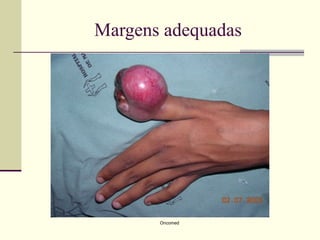 Margens adequadas




       Oncomed
 