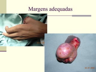 Margens adequadas




       Oncomed
 