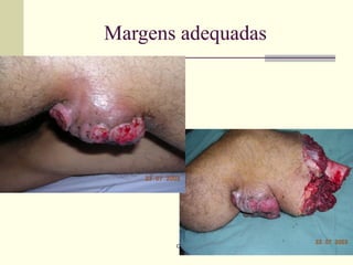 Margens adequadas




       Oncomed
 