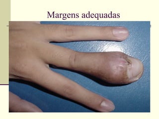 Margens adequadas




       Oncomed
 