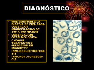 DIAGNÓSTICO

• MAS CONFIABLE LA
  BIOPSIA DE PIEL PARA
  OBSERVAR
  MICROFILARIAS DE
  300 A 400 MICRAS
• OBSERVACION
  OFTALMOLOGICA
• CHOQUE
  TERAPEUTICO
  “REACCION DE
  MAZZOTTI”
• INMUNOELECTROFORE
  SIS
• INMUNOFLUORESCEN
  CIA
 