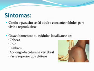 Síntomas:
 Cando o parasito se fai adulto constrúe nódulos para
 vivir e reproducirse.

 Os avultamentos ou nódulos localízanse en:
 •Cabeza
 •Colo
 •Ombros
 •Ao longo da columna vertebral
 •Parte superior dos glúteos
 