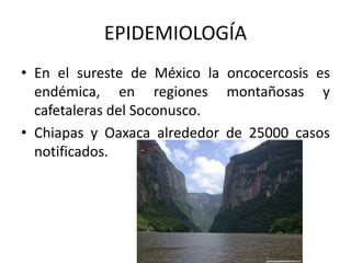 EPIDEMIOLOGÍA
• En el sureste de México la oncocercosis es
endémica, en regiones montañosas y
cafetaleras del Soconusco.
• Chiapas y Oaxaca alrededor de 25000 casos
notificados.
 