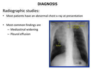 DIAGNOSIS
Radiographic studies:
• Most patients have an abnormal chest x-ray at presentation
• Most common findings are
– Mediastinal widening
– Pleural effusion
 