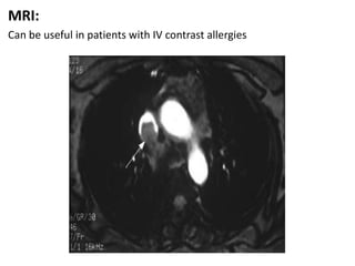 MRI:
Can be useful in patients with IV contrast allergies
 