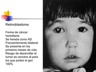 Retinoblastoma Forma de cáncer hereditaria  Se hereda como AD Frecuentemente bilateral Se presenta en los primeros meses de vida Riesgo de desarrollar el tumor es cercano al para los que portan el gen 100% 