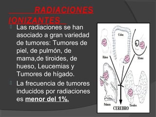 RADIACIONES
IONIZANTES
 Las radiaciones se han
asociado a gran variedad
de tumores: Tumores de
piel, de pulmón, de
mama,de tiroides, de
hueso, Leucemias y
Tumores de hígado.
 La frecuencia de tumores
inducidos por radiaciones
es menor del 1%.
 