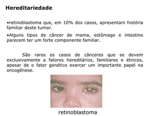 Hereditariedade
•retinoblastoma que, em 10% dos casos, apresentam história
familiar deste tumor.
•Alguns tipos de câncer de mama, estômago e intestino
parecem ter um forte componente familiar.
São raros os casos de cânceres que se devem
exclusivamente a fatores hereditários, familiares e étnicos,
apesar de o fator genético exercer um importante papel na
oncogênese.
retinoblastoma
 