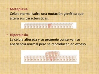 • Metaplasia
  Célula normal sufre una mutación genética que
  altera sus características.



• Hiperplasia
  La célula alterada y su progenie conservan su
  apariencia normal pero se reproducen en exceso.
 