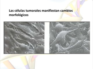 Las células tumorales manifiestan cambios morfológicos
