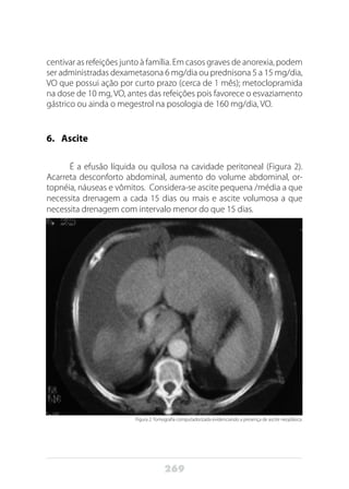 269
centivar as refeições junto à família. Em casos graves de anorexia, podem
ser administradas dexametasona 6 mg/dia ou prednisona 5 a 15 mg/dia,
VO que possui ação por curto prazo (cerca de 1 mês); metoclopramida
na dose de 10 mg, VO, antes das refeições pois favorece o esvaziamento
gástrico ou ainda o megestrol na posologia de 160 mg/dia, VO.
6.	Ascite
É a efusão líquida ou quilosa na cavidade peritoneal (Figura 2).
Acarreta desconforto abdominal, aumento do volume abdominal, or-
topnéia, náuseas e vômitos. Considera-se ascite pequena /média a que
necessita drenagem a cada 15 dias ou mais e ascite volumosa a que
necessita drenagem com intervalo menor do que 15 dias.
Figura 2: Tomografia computadorizada evidenciando a presença de ascite neoplásica.
 