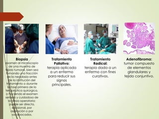 Biopsia
examen al microscopio
de una muestra de
tejido tumoral, bien sea
tomando una fracción
de la neoplasia antes
de la institución del
tratamiento o durante
la fase primera de la
terapéutica quirúrgica,
o haciendo el examen
seriado y cuidadoso de
la pieza operatoria;
puede ser directa,
excisional, por
aspiración o por
sacabocados.
Tratamiento
Paliativo:
terapia aplicada
a un enfermo
para reducir sus
signos
principales.
Tratamiento
Radical:
terapia dada a un
enfermo con fines
curativos.
Adenofibroma:
tumor compuesto
de elementos
glandulares y
tejido conjuntivo.
 