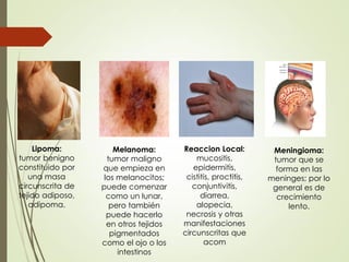 Lipoma:
tumor benigno
constituido por
una masa
circunscrita de
tejido adiposo,
adipoma.
Melanoma:
tumor maligno
que empieza en
los melanocitos;
puede comenzar
como un lunar,
pero también
puede hacerlo
en otros tejidos
pigmentados
como el ojo o los
intestinos
Reaccion Local:
mucositis,
epidermitis,
cistitis, proctitis,
conjuntivitis,
diarrea,
alopecia,
necrosis y otras
manifestaciones
circunscritas que
acom
Meningioma:
tumor que se
forma en las
meninges; por lo
general es de
crecimiento
lento.
 