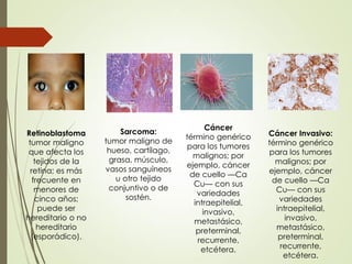 Sarcoma:
tumor maligno de
hueso, cartílago,
grasa, músculo,
vasos sanguíneos
u otro tejido
conjuntivo o de
sostén.
Retinoblastoma
tumor maligno
que afecta los
tejidos de la
retina; es más
frecuente en
menores de
cinco años;
puede ser
hereditario o no
hereditario
(esporádico).
Cáncer Invasivo:
término genérico
para los tumores
malignos; por
ejemplo, cáncer
de cuello —Ca
Cu— con sus
variedades
intraepitelial,
invasivo,
metastásico,
preterminal,
recurrente,
etcétera.
Cáncer
término genérico
para los tumores
malignos; por
ejemplo, cáncer
de cuello —Ca
Cu— con sus
variedades
intraepitelial,
invasivo,
metastásico,
preterminal,
recurrente,
etcétera.
 