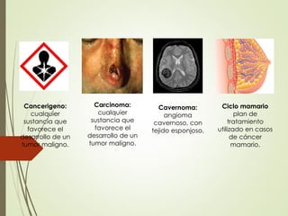 Carcinoma:
cualquier
sustancia que
favorece el
desarrollo de un
tumor maligno.
Cancerigeno:
cualquier
sustancia que
favorece el
desarrollo de un
tumor maligno.
Ciclo mamario
plan de
tratamiento
utilizado en casos
de cáncer
mamario.
Cavernoma:
angioma
cavernoso, con
tejido esponjoso.
 