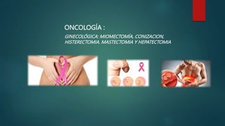 ONCOLOGÍA :
GINECOLÓGICA: MIOMECTOMÍA, CONIZACION,
HISTERECTOMIA. MASTECTOMIA Y HEPATECTOMIA
 