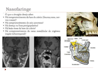 Nasofaringe
 