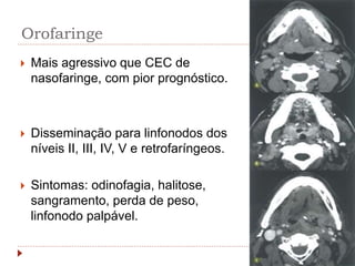 Orofaringe
 Mais agressivo que CEC de
nasofaringe, com pior prognóstico.
 Disseminação para linfonodos dos
níveis II, III, IV, V e retrofaríngeos.
 Sintomas: odinofagia, halitose,
sangramento, perda de peso,
linfonodo palpável.
 