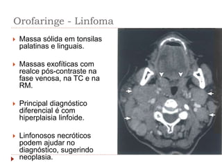 Orofaringe - Linfoma
 Massa sólida em tonsilas
palatinas e linguais.
 Massas exofíticas com
realce pós-contraste na
fase venosa, na TC e na
RM.
 Principal diagnóstico
diferencial é com
hiperplaisia linfoide.
 Linfonosos necróticos
podem ajudar no
diagnóstico, sugerindo
neoplasia.
 
