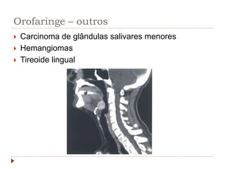 Orofaringe – outros
 Carcinoma de glândulas salivares menores
 Hemangiomas
 Tireoide lingual
 