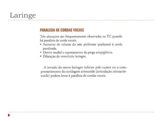 Laringe
 