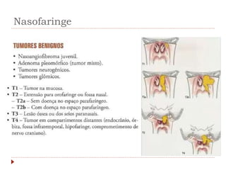 Nasofaringe
 