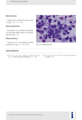 CAPITULO I ESTUDIO CITOLOGICO DE NEOPLASIAS CUTANEAS
ONCOLOGIA CUTANEA
i
Fig. 16.—Fibrosarcoma
1. COWELL, R.L. y TYLER, R.D.: «Diagnostic cytology of the dog
and cat». American Veterinary Publications, Inc., 1989.
2. PERMAN, V.; ALSAKER, R.D. y RIIS, R.C.: «Cytology of the dog and
cat». AAHA, 1979.
BIBLIOGRAFIA
Macrocitosis
Presencia de células de gran tama-
ño (figs. 10, 11 y 14).
Hipercelularidad
Incremento en la exfoliación debido
a la alta densidad celular en el tejido
afectado (fig. 15).
Pleomorfismo
Variación en la morfología celular
(presente en figs. 11, 12 y 16).
 