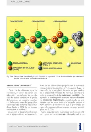CAPITULO II CARCINOGENESIS, p53 Y NEOPLASIAS CUTANEAS
NEOPLASIAS CUTANEAS
Dentro de los diferentes tipos de
neoplasias, el cáncer de piel en sen-
tido estricto (no incluidas las neopla-
sias de tejidos blandos) es el grupo
de tumores en los cuales la importan-
cia de las mutaciones del gen p53 se
ha demostrado de forma más contun-
dente (hasta el 90% de los tumores
cutáneos en el hombre)21.
En general, el desarrollo del cáncer
en el tejido cutáneo se basa en la
suma de las alteraciones que producen 4 patomeca-
nismos independientes (fig. 6)11. En primer lugar, el
desarrollo de la neoplasia depende en gran medida
de la capacidad intrínseca del individuo para llevar a
cabo la reparación de las mutaciones en el ADN. Por
ejemplo, el hombre puede sufrir una trastorno heredita-
rio (Xeroderma Pigmentosum), caracterizado por una
incapacidad en estos individuos en poder reparar el
ADN dañado. El resultado es que la posibilidad de
desarrollar cáncer cutáneo en estas personas se multi-
plica por 1.000.
Como segundo factor involucrado en el cáncer cutá-
neo aparecen los eicosanoides (derivados del ácido
ONCOLOGIA CUTANEA
i
Fig. 5.— La mutación parcial del gen p53 favorece la expansión clonal de estas células y aumenta con
ello las posibilidades de desarrollar el cáncer.
 