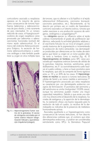 corticoidismo asociado a neoplasias
aparece en la mayoría de perros
como consecuencia de tumores hipo-
fisarios (adenomas y adenocarcino-
mas de pars distalis, y más raramente
de pars intermedia). En un número
reducido de casos, el hiperglucocorti-
coidismo de origen neoplásico viene
provocado por adenomas o adeno-
carcinomas funcionales (cortisol) del
mismo tejido adrenocortical. En el
marco del síndrome Adrenocorticotró-
pico Ectópico, la secreción de hor-
mona adrenocorticotrópica o sustan-
cias análogas a ésta también puede
tener su origen en otros múltiples tipos
CAPITULO IV SINDROMES PARANEOPLASICOS CUTANEOS Y NEOPLASIAS CUTANEAS SECUNDARIAS:
MARCADORES DE CANCER
de tumores, que no afectan ni a la hipófisis ni al tejido
adrenocortical (linfosarcoma, carcinoma bronquial,
carcinoma pancreático, etc.). Recientemente, se ha
descrito por primera vez un cuadro de hiperadreno-
corticismo asociado a un luteoma ovárico, tumores que
suelen asociarse a una producción excesiva de estró-
genos, andrógenos o progestágenos30.
Los estrógenos ejercen su influencia sobre el tejido
cutáneo incrementando el grado de proliferación epi-
dérmica, reduciendo la actividad glandular sebácea y
el crecimiento folicular (no se inicia el anagen), provo-
cando trastornos de la pigmentación e incrementando
la producción de matriz extracelular. Las dermatopatí-
as producidas por alteraciones en los niveles de estró-
genos que tienen su origen en un tumor pueden afec-
tar tanto a hembras como a machos (fig. 4). El
Hiperestrogenismo en hembras como SPC viene pro-
vocado por neoplasias ováricas (tumores de células de
la granulosa, luteomas, tecomas, sertolinomas, gona-
doblastomas, etc.)6. La ovariohisterectomía suele resol-
ver el cuadro cutáneo, y tiene un buen pronóstico para
la neoplasia, que sólo se comporta de forma agresiva
entre un 10 y un 20% de los casos. El Hiperestroge-
nismo en machos se asocia a tumores testiculares de
células de Sertoli y en menor medida a seminomas.27
El hiperestrogenismo provocado por estas neoplasias
se caracteriza por una dermatopatía endocrina con
signos de feminización. El pronóstico del seminoma y
del sertolinoma es similar (malignidad 10-20% casos),
aunque los seminomas pueden mostrar una mayor
capacidad metastática. Debido a que existe una rela-
ción muy directa entre el desarrollo de la neoplasia, los
niveles de estrógenos y la aparición de la dermatopa-
tía, la castración ofrece una buena respuesta para la
resolución de todo el cuadro. La recidiva de la der-
matopatía es indicativa de la presencia de metástasis
hormonalmente activas.
Asociadas igualmente a un hiperestrogenismo como
consecuencia de tumores testiculares, se han descrito
dos alteraciones cutáneas que, al contrario que otras
dermatopatías endocrinas, sí podrían ser consideradas
estrictamente como SPCs: la Dermatosis Prepucial
ONCOLOGIA CUTANEA
i
Fig. 4.— Hiperestrogenismo-Tumor ová-
rico de la granulosa. El exceso
de estrógenos secretados por el
tumor ovárico inducen teloge-
nización folicular y queratiniza-
ción triquilemal (catagen).
 