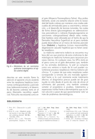 descritas en esta revisión llama la
atención el aparente vínculo existente
entre las neoplasias hepáticas (carci-
nomas conlangiocelulares) y pancreá-
ticas (adenocarcinomas) y el desarro-
llo de lesiones cutáneas tanto en el
perro (Dermatitis necrolítica superfi-
cial, Paniculitis necrotizante) como en
CAPITULO IV SINDROMES PARANEOPLASICOS CUTANEOS Y NEOPLASIAS CUTANEAS SECUNDARIAS:
MARCADORES DE CANCER
el gato (Alopecia Paraneoplásica Felina). Muy proba-
blemente, existe una estrecha relación entre la necesi-
dad del tejido cutáneo por mantener unos niveles ade-
cuados de aminoácidos para su crecimiento y renova-
ción, y el desarrollo de lesiones tumorales, las cuales
de forma directa (gluconeogénesis en adenocarcino-
mas pancreáticos) o indirecta (hiperglucagonemia en
carcinomas colangiocelulares) alteran estos niveles.
Esta hipótesis viene reforzada por el hecho de que la
Dermatitis Necrolítica Superficial en el perro también
puede desarrollarse en el marco de lesiones pancreá-
ticas (Diabetes) y hepáticas (cirrosis macronodulillar,
degeneración vacuolar hepática) que no tienen carac-
ter neoplásico.
La medicina veterinaria todavía se encuentra muy
lejos del uso que practica de estos síndromes la der-
matología en medicina humana para reconocer pro-
cesos internos. En cualquier caso, los SPCs tanto en
el perro como en el gato demuestran que, también
en los animales domésticos, la piel se comporta
como una ventana a través de la cual pueden vis-
lumbrarse procesos neoplásicos internos todavía sub-
clínicos. Y, a pesar de que estas neoplasias suelen
corresponder a tumores de una marcada agresivi-
dad frente a la cual raramente existe tratamiento
efectivo, el diagnóstico precoz puede ser de gran
ayuda no sólo desde el punto de vista de aliviar el
sufrimiento del paciente, sino también evitando
someter al propietario a pruebas, tratamientos y
esperanzas inútiles frente a dermatopatías que no tie-
nen solución a pesar de que aparentemente "sólo" se
trate de problemas dermatológicos.
ONCOLOGIA CUTANEA
i
Fig. 8.— Metástasis de un carcinoma
pulmonar broncogénico al teji-
do cutáneo digital.
1. ATLEE, B.A.: Observación no publi-
cada.
2. BOND, R. y cols.: «Metabolic epider-
mal necrosis in two dogs with diffe-
rent underlying diseases". Vet. Rec.,
136:466, 1995.
3. BROOKS, D.G. y cols.: "Pancreatic
paraneoplastic alopecia in three
cats". J. Am. Anim. Hosp. Assoc.
30:557, 1994.
4. CARPENTER, J.L. y HOLZWORTH, J.:
"Thymoma in 11 cats". J. Am. Vet.
Med. Assoc. 181:248, 1982.
5. CROWE, D.T. y TODOROFF, R.J.:
"Umbilical masses and dicoulorations
as signs of intrabdominal disease". J.
Am. Anim. Hosp. Assoc. 18:295,
1982.
6. FAYRER-HOSKEN, R.A. y cols.: "Follicular
cystic ovaries and cystic endometrail
hyperplasia in a bitch". J. Am. Vet.
Med. Assoc. 201:107, 1992.
7. FREINKEL, R.K.: «Cutaneous manifesta-
tions of endocrine disease». En:
BIBLIOGRAFIA
 