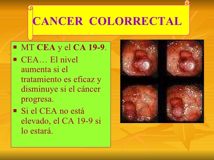 Oncologia Marcadores Tumorales2 Oncologia Marcadores Tumorales2