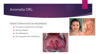 Anomalía ORL:
SIGNOS SOSPECHOSOS DE MALIGNIDAD:
 El carácter reciente de la anomalía.
 No hay mejoría.
 No inflamatoria.
 Sin respuesta a los antibióticos
 