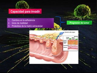 Capacidad para invadir
1. Cambios en la adherencia
2. Inicio de motilidad
3. Proteólisis de la matriz extracelular
Progresión de tumor
 