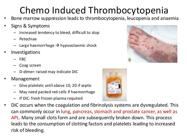 Oncological Emergencies Oncological Emergencies