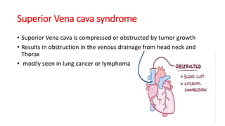 Superior Vena cava syndrome
• Superior Vena cava is compressed or obstructed by tumor growth
• Results in obstruction in the venous drainage from head neck and
Thorax
• mostly seen in lung cancer or lymphoma
 