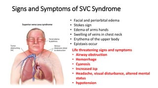 Signs and Symptoms of SVC Syndrome
• Facial and periorbital edema
• Stokes sign
• Edema of arms hands
• Swelling of veins in chest neck
• Erythema of the upper body
• Epistaxis occur
Life threatening signs and symptoms
• Airway obstruction
• Hemorrhage
• Cyanosis
• Increased icp
• Headache, visual disturbance, altered mental
status
• hypotension
 