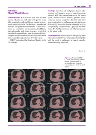 MWEBAZA VICTOR - Oncologic and Cardiologic PET CT Diagnosis.pdf