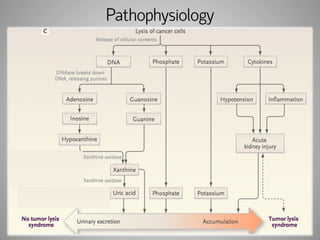 Pathophysiology 
 