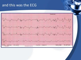 and this was the ECG

 