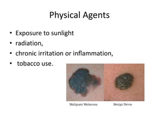 Physical Agents
• Exposure to sunlight
• radiation,
• chronic irritation or inﬂammation,
• tobacco use.
 