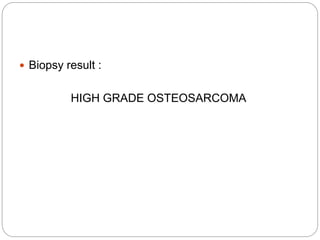  Biopsy result :
HIGH GRADE OSTEOSARCOMA
 