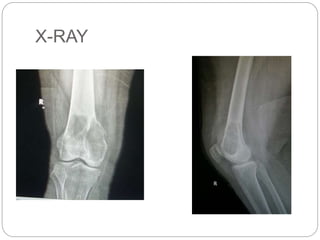 X-RAY
 