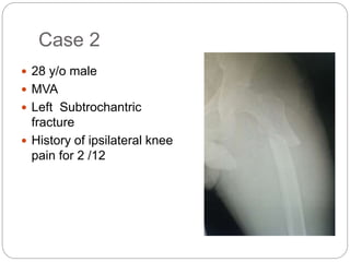 Case 2
 28 y/o male
 MVA
 Left Subtrochantric
fracture
 History of ipsilateral knee
pain for 2 /12
 