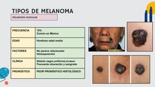 TIPOS DE MELANOMA
FRECUENCIA 15%
Común en México
EDAD Hombres edad media
FACTORES No parece relacionado
fotoexposición
CLÍNICA Nódulo negro,uniforme,invasor
Frecuente ulceración y sangrado
PRONÓSTICO PEOR PRONÓSTICO HISTOLÓGICO
MELANOMA NODULAR
 