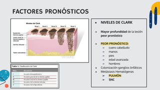 FACTORES PRONÓSTICOS
● NIVELES DE CLARK
● Mayor profundidad de la lesión
peor pronóstico
● PEOR PRONÓSTICO:
➢ cuero cabelludo
➢ manos
➢ pies
➢ edad avanzada
➢ hombres
● Colonización ganglios linfáticos
● Metástasis Hematógenas
➢ PULMÓN
➢ SNC
 
