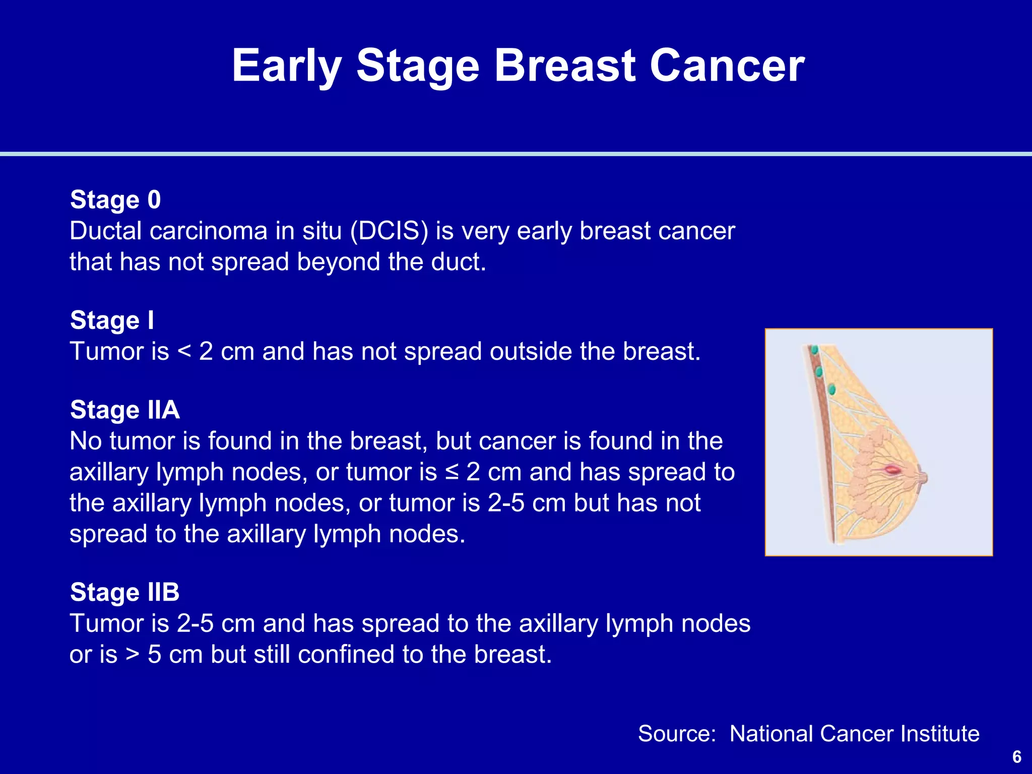 6
Early Stage Breast Cancer
Stage 0
Ductal carcinoma in situ (DCIS) is very early breast cancer
that has not spread beyond the duct.
Stage I
Tumor is < 2 cm and has not spread outside the breast.
Stage IIA
No tumor is found in the breast, but cancer is found in the
axillary lymph nodes, or tumor is ≤ 2 cm and has spread to
the axillary lymph nodes, or tumor is 2-5 cm but has not
spread to the axillary lymph nodes.
Stage IIB
Tumor is 2-5 cm and has spread to the axillary lymph nodes
or is > 5 cm but still confined to the breast.
Source: National Cancer Institute
 
