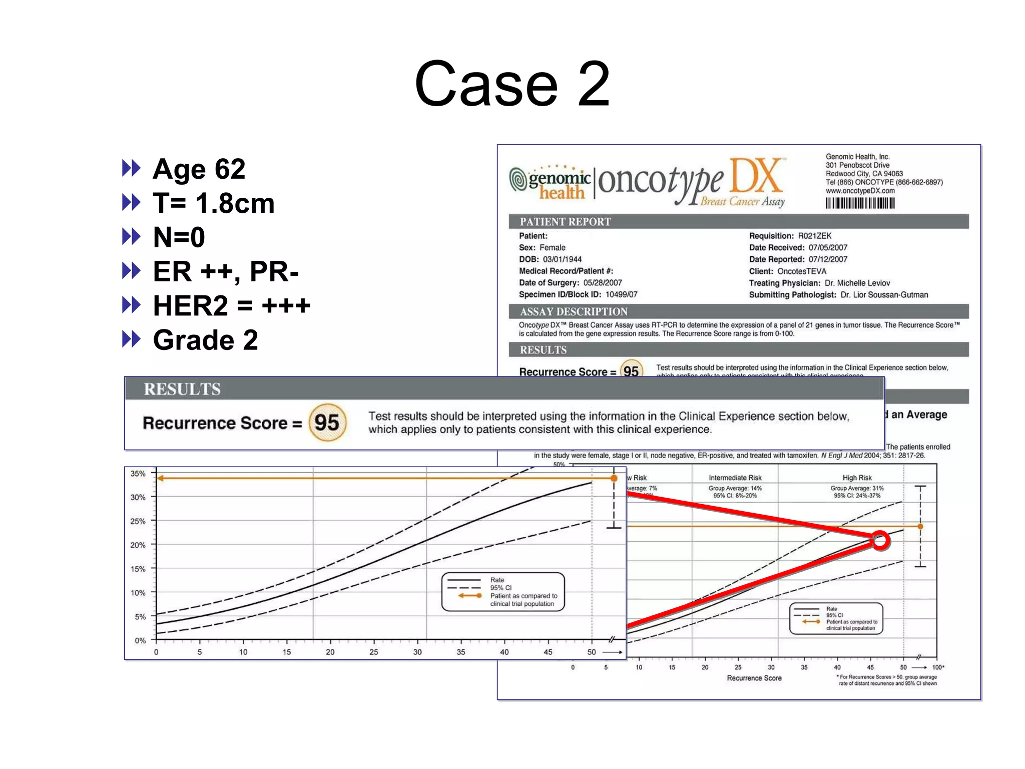 Case 2 Age  62 T=   1.8cm N=0 ER ++, PR -  HER2 = +++ Grade 2  