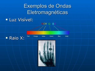 Exemplos de Ondas Eletromagnéticas Luz Visível: Raio X: 
