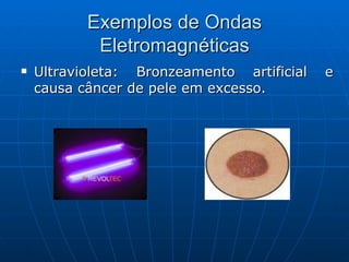 Exemplos de Ondas Eletromagnéticas Ultravioleta: Bronzeamento artificial e causa câncer de pele em excesso.  